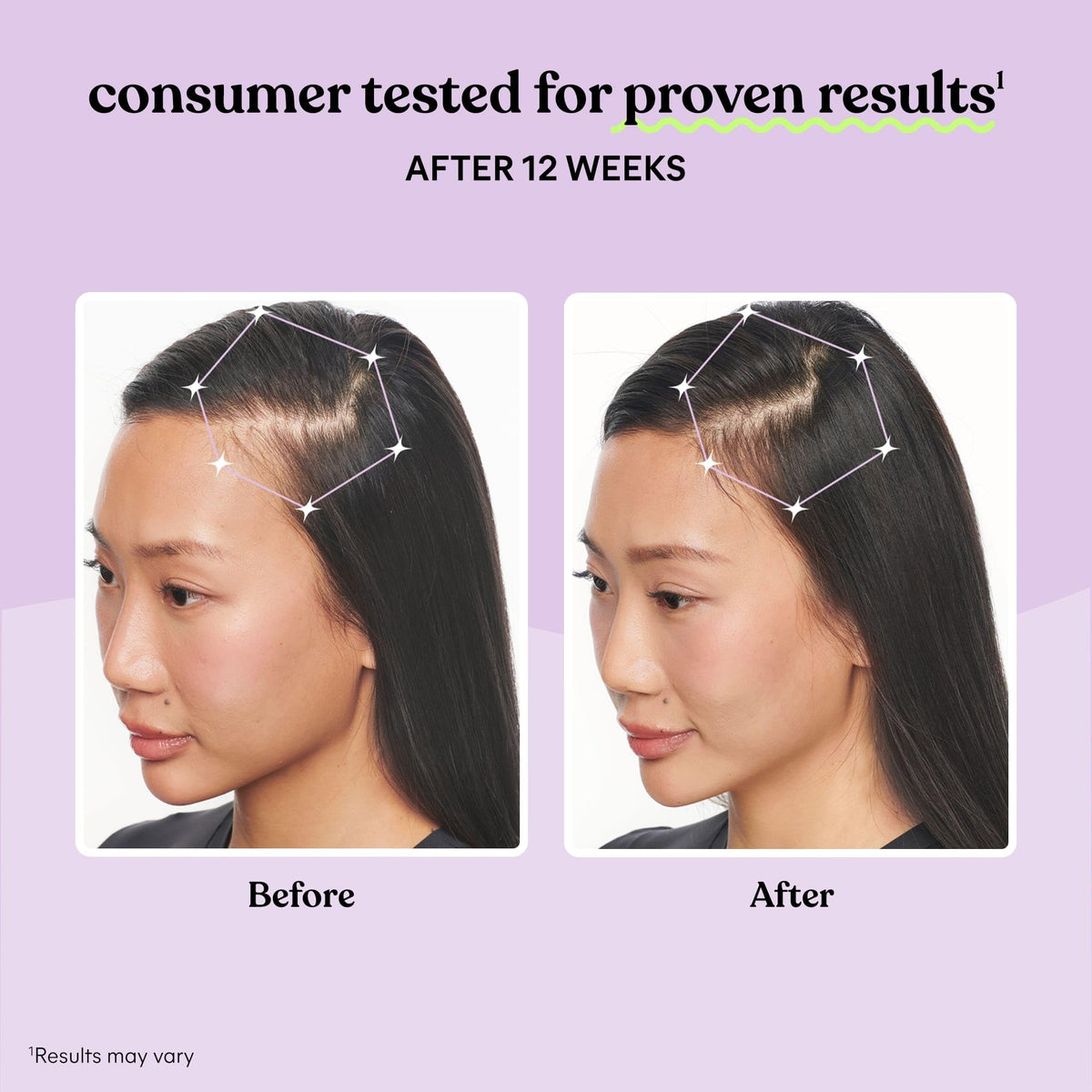 Hair Growth Capsules 30-Day Supply J2694