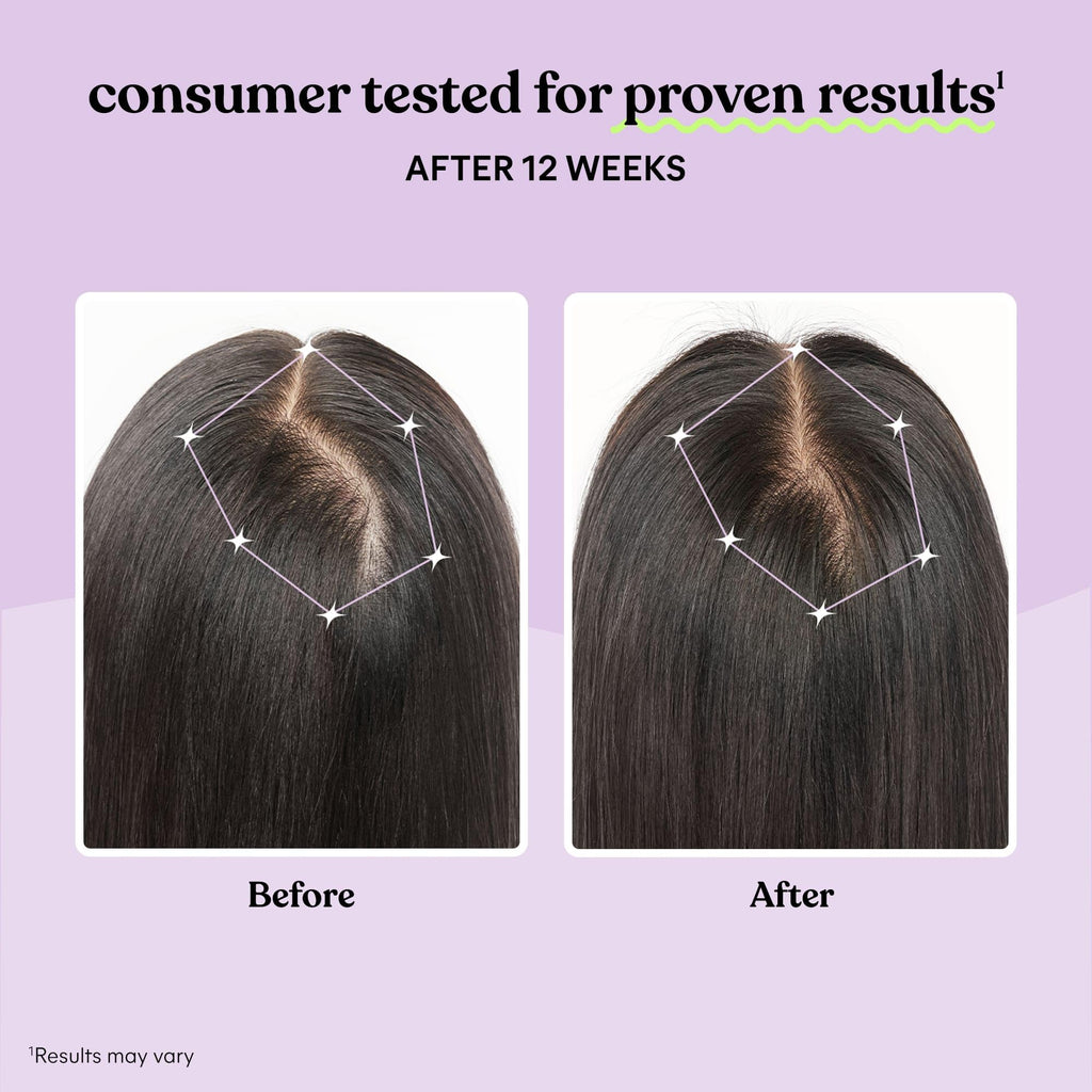 Hair Growth Capsules 30-Day Supply J2694